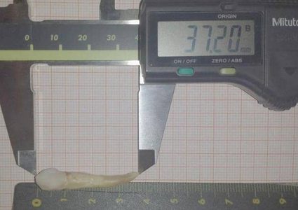 طبيب أسنان يدخل "غينيس" بعد اقتلاعه أطول سن بشري في العالم