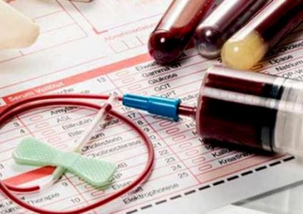 إختبار دم يتنبأ بخطر سرطان الثدي قبل 5 سنوات من ظهور الأعراض