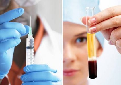 تطوير تقنية ثورية لمحو آثار حب الشباب