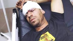 رام الله: إصابة سائق عمومي بحجارة المستوطنين