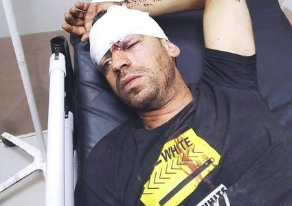 رام الله: إصابة سائق عمومي بحجارة المستوطنين