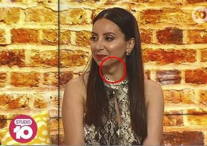 أستراليا.. لقاء تلفزيوني ينقذ مذيعة من إصابتها بمرض خطير !