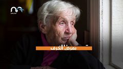 مفاجأة .. مرض خطير سببه كثرة النوم