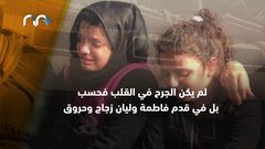 صرخة الطفلة ليان بهاء أبو العطا وجدت صداها بقلوب الناس!