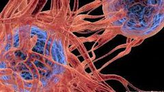 مادة ملونة تساعد في تحديد مكان السرطان