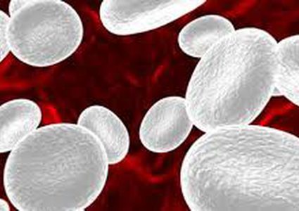 ما هو المرض الذي يحول لون الدم إلى الأبيض ؟