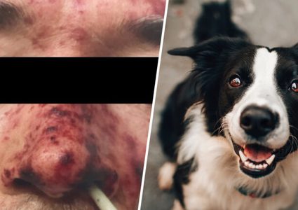 لعقة كلب تصيب صاحبه بأمراض خطيرة وتفتك به !