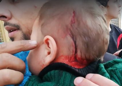 إصابة رضيع في رأسه بهجوم المستوطنين على المواطنين وسط الخليل