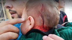 إصابة رضيع في رأسه بهجوم المستوطنين على المواطنين وسط الخليل