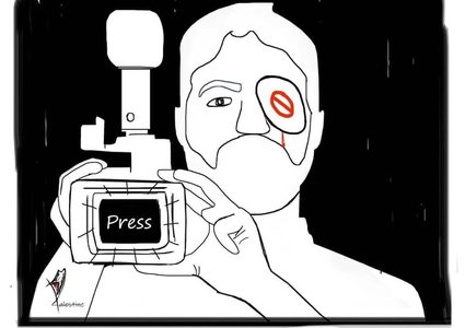 الزميل عمارنة يروي لـ"النجاح" تفاصيل اطلاق النار عليه وإصابته