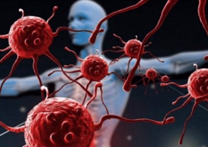 بعد قهرها سرطان الجلد.. السرطان يعود ليفتك بجسد شابة عشرينية