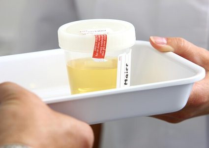 طريقة جديدة لتشخيص سرطان البروستاتا