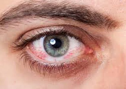 ما هي اسباب ظهور بقع الدم في العين ؟