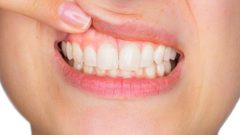 ما هي علاقة السمنة بأمراض اللثة ؟