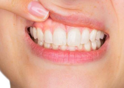 ما هي علاقة السمنة بأمراض اللثة ؟