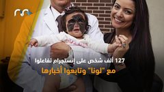 حالة نادرة جدا طفلة ولدت بقناع "باتمان" !