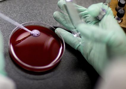 تغيير غريب ومفاجئ يطرأ على جسد رجل بعد زراعة نخاع عظم