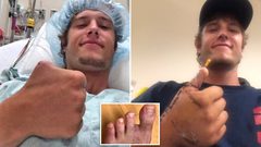 أطباء يوفرون بديل غريب لإبهام رجل فقده في حادث أثناء عمله !