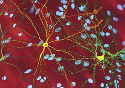 اكتشاف وسيلة لعلاج مرض يصيب الجهاز العصبي