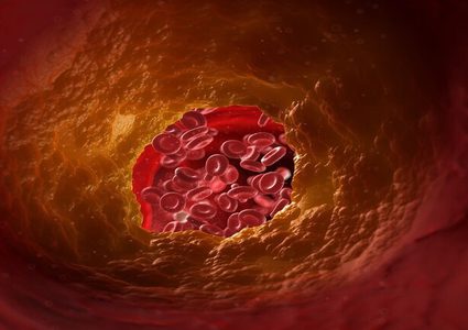 فاكهة تساهم في خفض الكوليسترول !