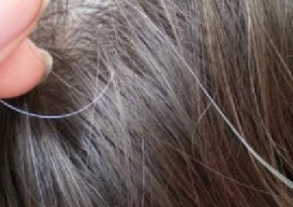 الإرهاق والتدخين عاملان يسببان الشيب المبكر للشعر