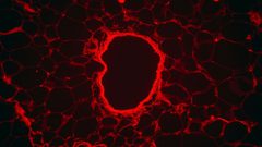 عقار ثوري يحارب سرطان الدم دون آثار جانبية "سامة"