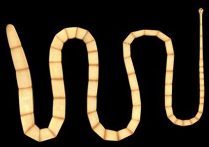 أبرز أعراض تكاثر الدودة الشريطية في أمعائك