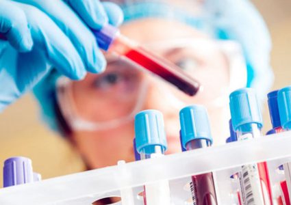 دراسة: السمنة تؤثر على دقة تحاليل الدم لدى الأطفال