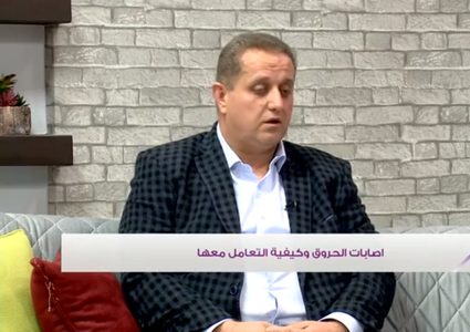 اصابات الحروق وكيفية التعامل معها