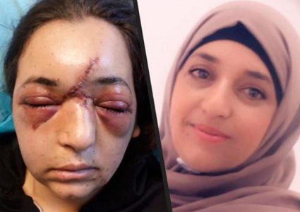 جندي إسرائيلي  يكسر جمجمة سيدة في العيسوية