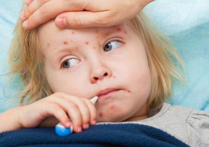 مدير الطب الوقائي: إصابة 110 شخصاً بالحصبة في غزة