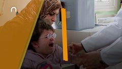 خطير .. 110 حالة اصابات بالحصبة في غزة