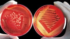 طريقة فرعونية تنقذ رجلا عجز الطب الحديث عن علاجه