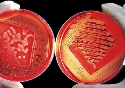 طريقة فرعونية تنقذ رجلا عجز الطب الحديث عن علاجه