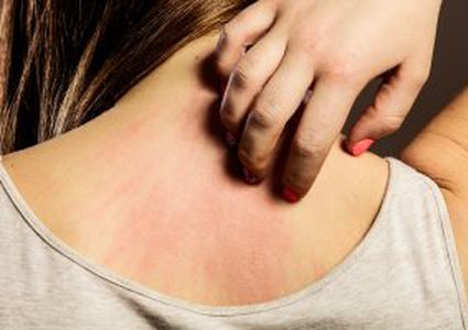 أخطر أسباب الإصابة بالطفح الجلدي