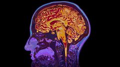 دراسة: حالات التهاب الدماغ تحدث بسبب فيروس ينقله الحيوان