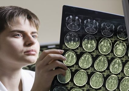 اكتشاف طريقة لتجديد قدرات الدماغ