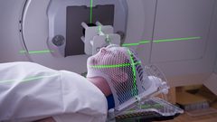 علاج السرطان بطريقة الإشعاع بفترة قياسية