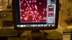 تطبيق يساعد شاب في اكتشاف اصابته بالسرطان