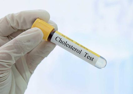 ما هي أهمية فحص نسبة الكوليسترول في الدم ؟