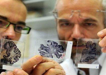 اكتشاف حقيقة غير متوقعة تتعلق بامتلاك دماغ أكبر حجما!