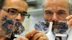 اكتشاف حقيقة غير متوقعة تتعلق بامتلاك دماغ أكبر حجما!