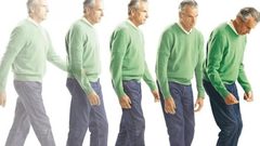 تحذير.. مرض "باركنسون" يبدأ بالتشكّل منذ الولادة