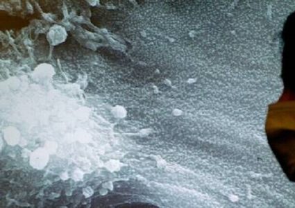 توقع زيادة أمراض السرطان بنسبة 81% في البلدان الفقيرة