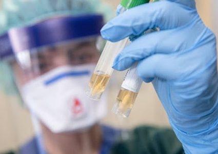 الصحة العالمية تؤكد عدم إكتشاف عقار لعلاج الكورونا