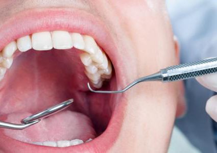 حالة نادرة.. نمو رموش في فم امرأة !