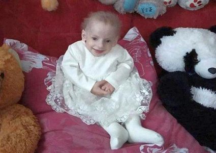 أوكرانيا تسجل أصغر حالة وفاة لمريض مصاب بـ"الشيخوخة المبكرة"