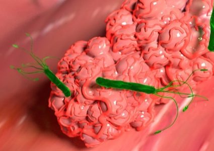 "بكتيريا البروبيوتيك".. بكتيريا مبرمجة على تدمير خلايا السرطان