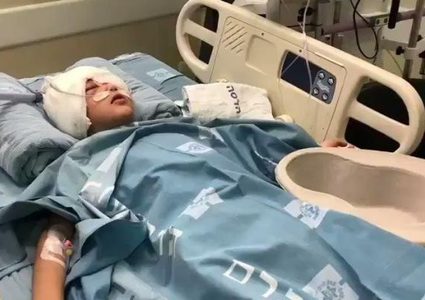 القدس:استئصال عين الطفل مالك عيسى بعد اصابته برصاص الاحتلال