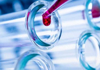 الصحة: فحوصات فيروس كورونا 2019 تجرى فقط بمختبر الصحة المركزي